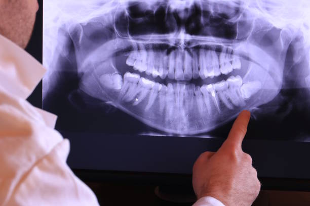 Best Emergency Wisdom Teeth Removal in Edwards Af, CA