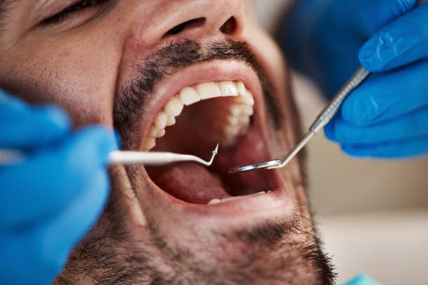 Best Emergency TMJ Treatment in Edwards Af, CA